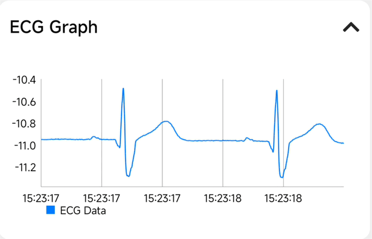 TIDA-010270 リアルタイムの ECG 波形